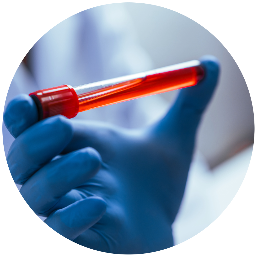 Gloved hand holding a vial of blood